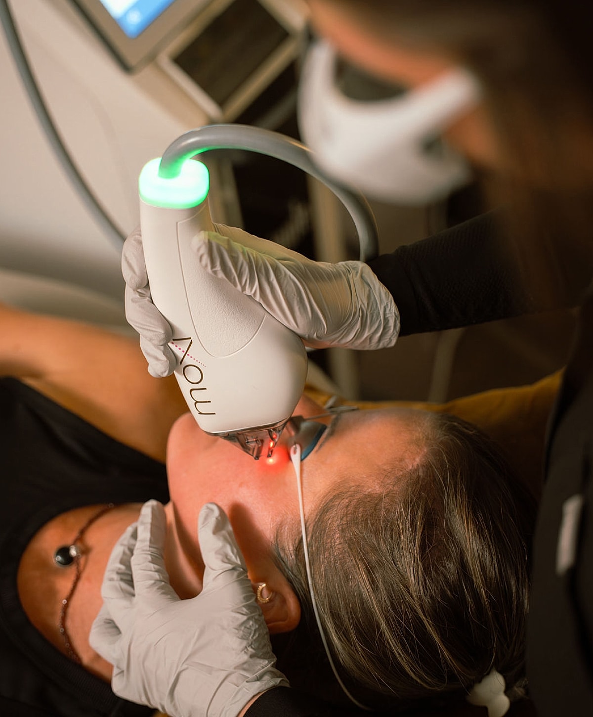Facial treatment using laser technology in progress.
