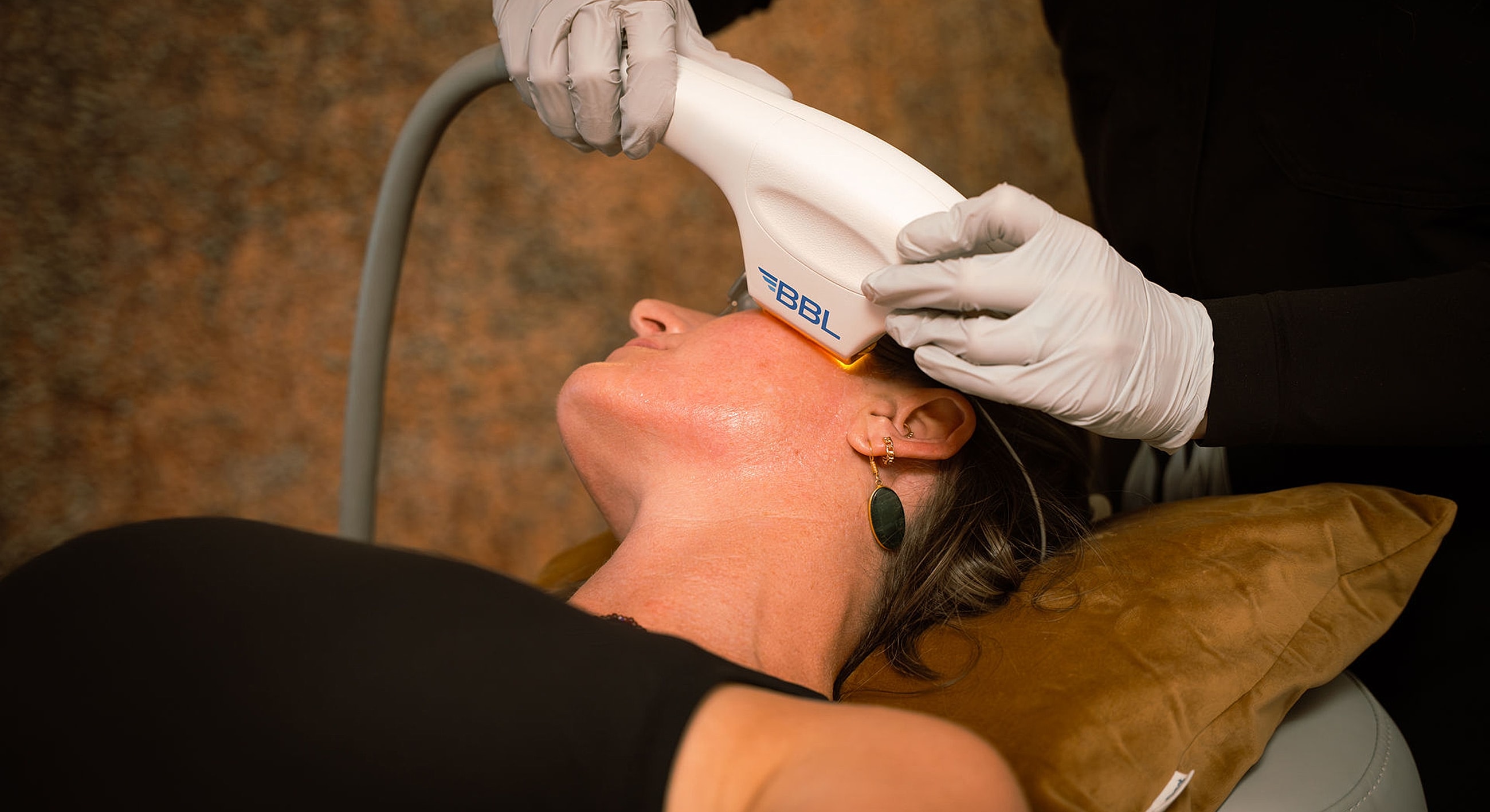 Patient receiving BBL facial treatment in clinic.